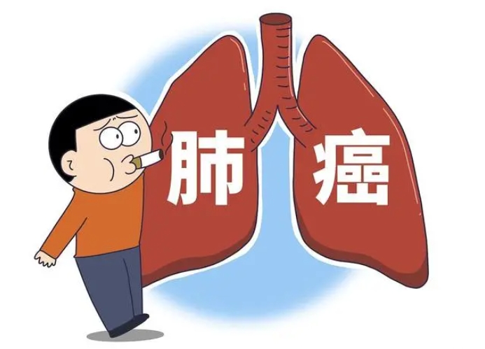 【合肥长淮中医医院】肺癌晚期已扩散病人能活多久? 【合肥长淮中医医院】肺癌晚期已扩散病人能活多久?